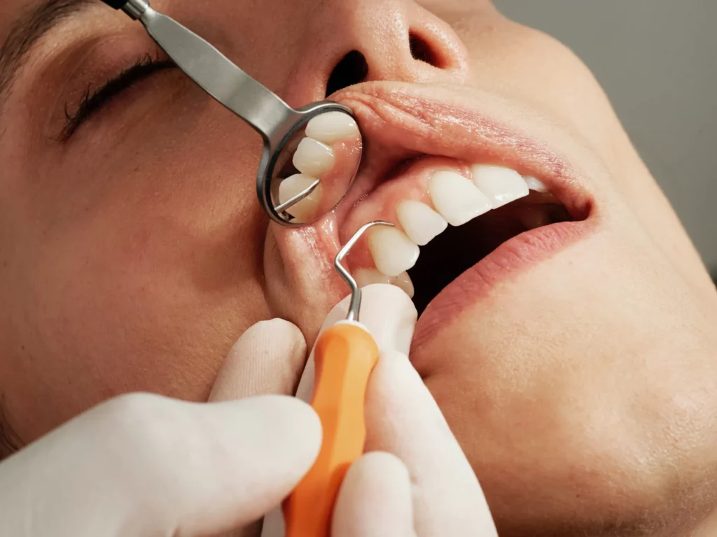 dental treatment